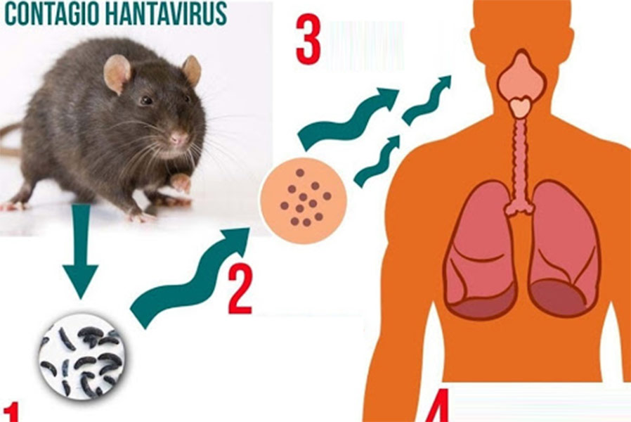 Hantavirus Explained: Symptoms, Causes, and How to Stay Safe